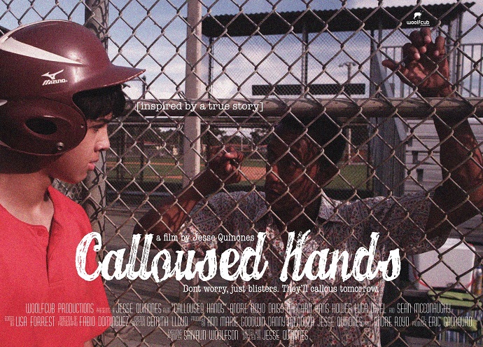 Calloused Hands