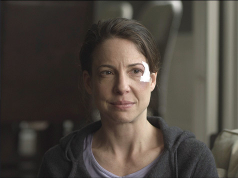 Concussion